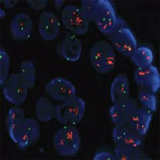 Chromotouch Chromosome SNP Microarray Optima, Prenatal
